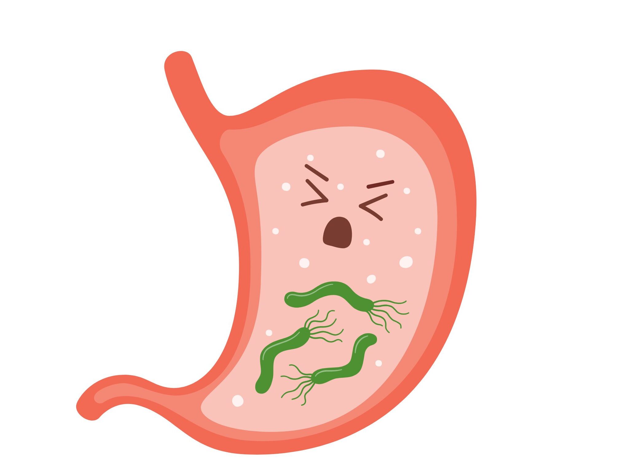 ピロリ菌を放置するとどうなる？胃がんリスクと除菌治療