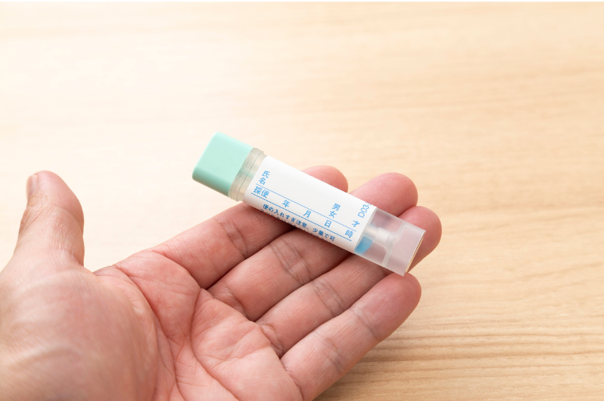 健診で「便潜血陽性」と出たらどうする？